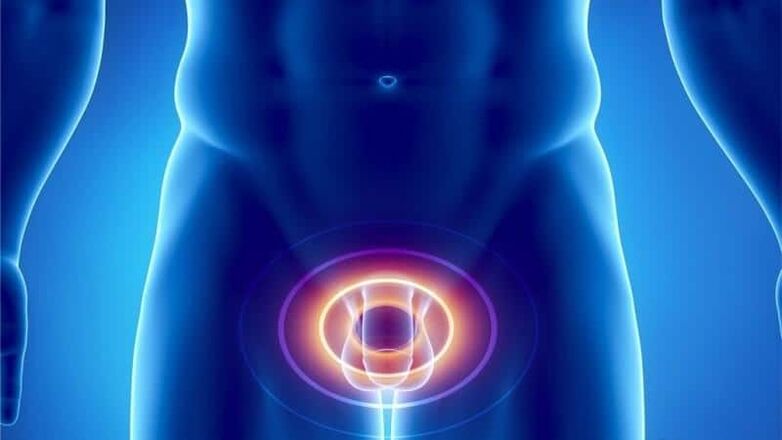 Prostatitis